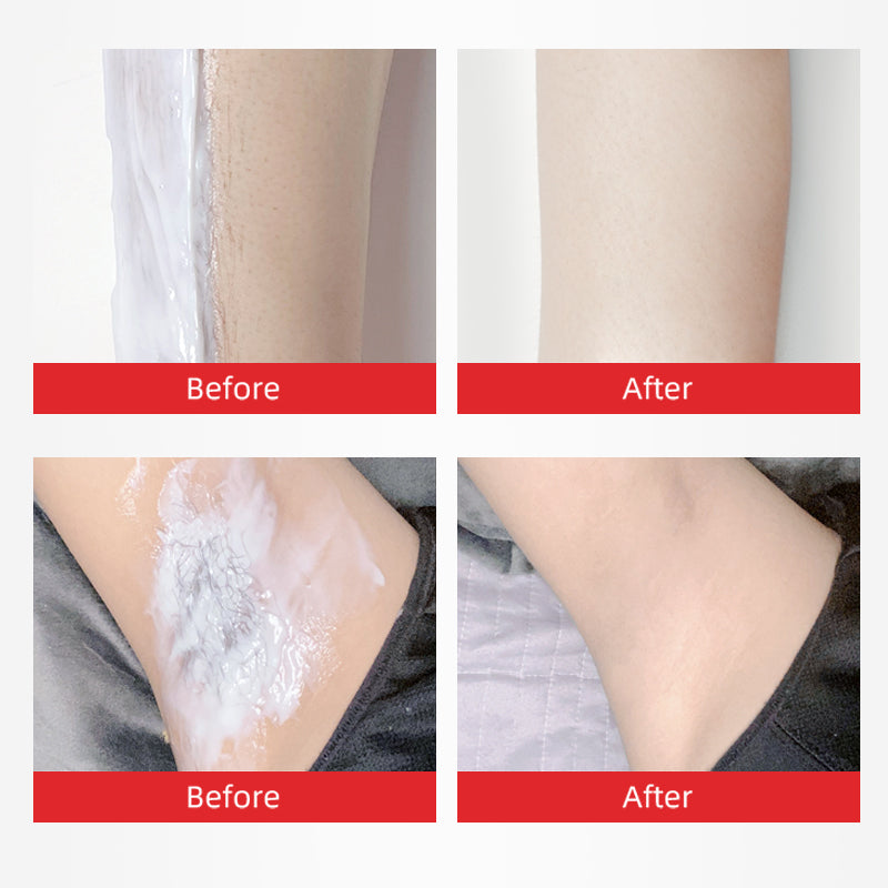 Sumax 100g Hair Removal Cream